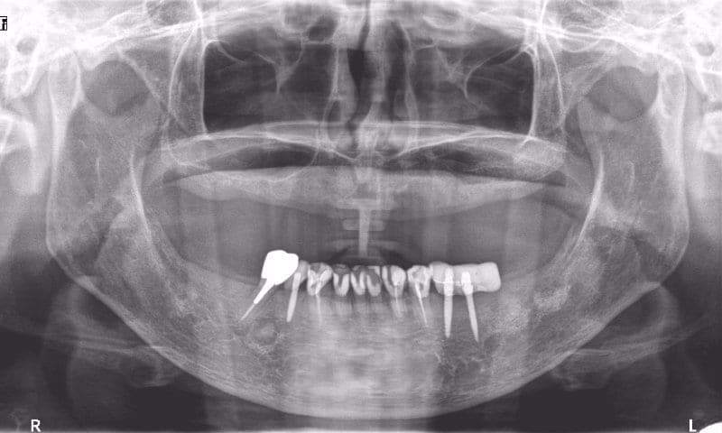 Practice example dental X-ray 6