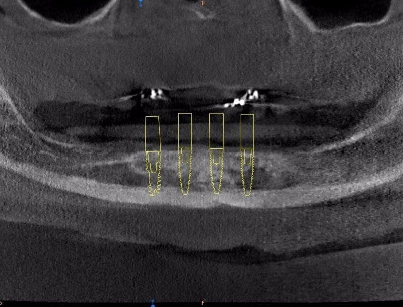 Practice example dental X-ray 7