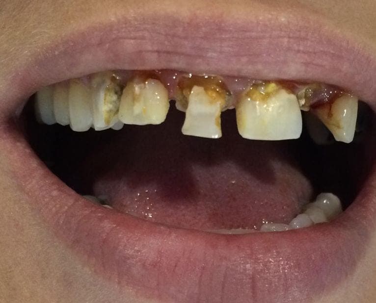 Case 1 — photo 3