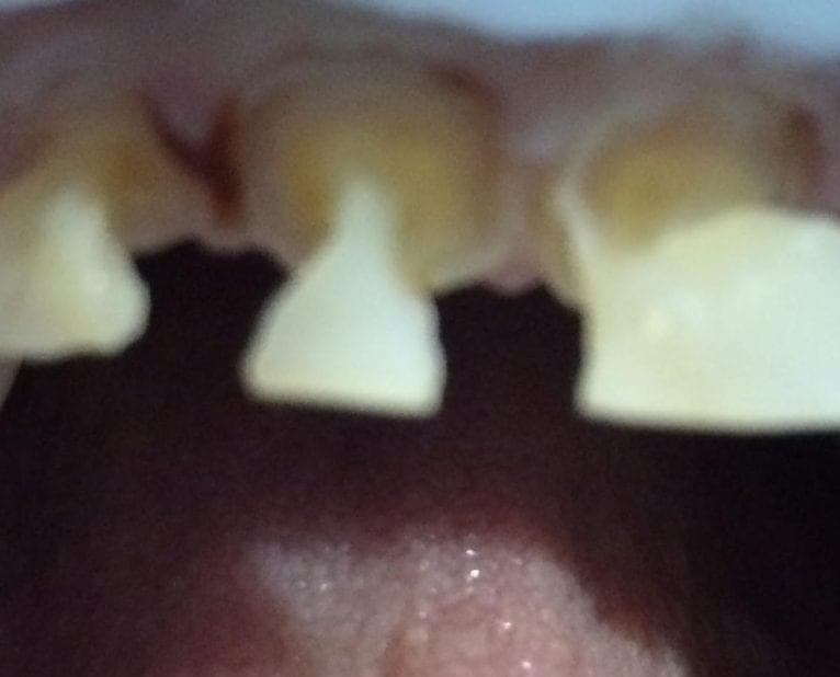 Case 1 — photo 2