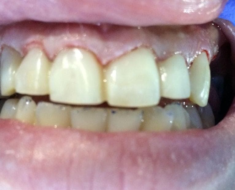 Case 1 — photo 1