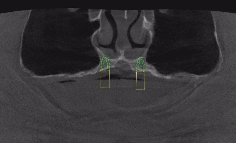 Practice example dental X-ray 8