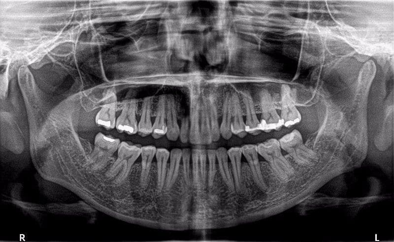 Practice example dental X-ray 9
