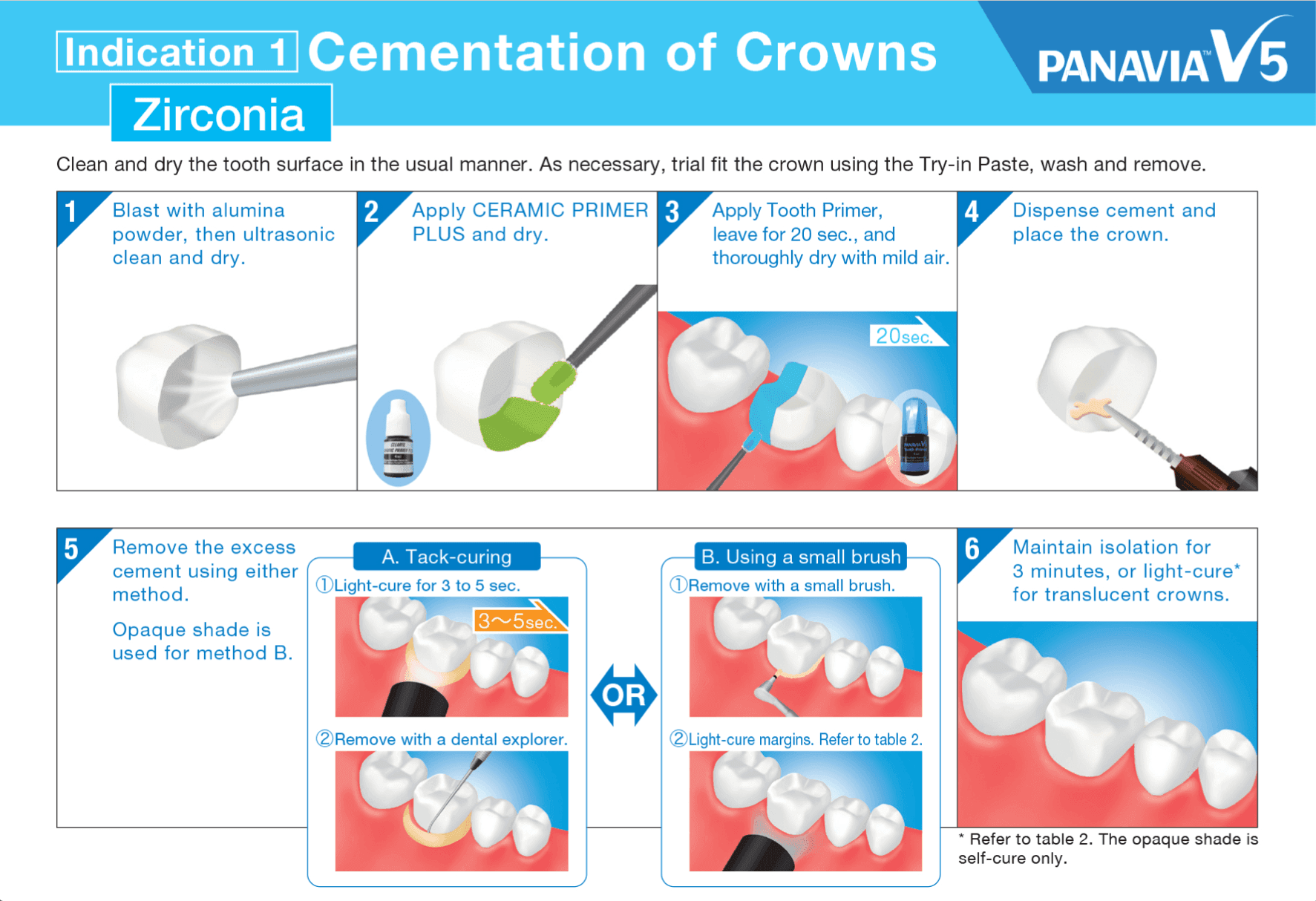 Zirconia Cement for Zirconia Crowns & Bridges Long Term Survival-Panavia V5