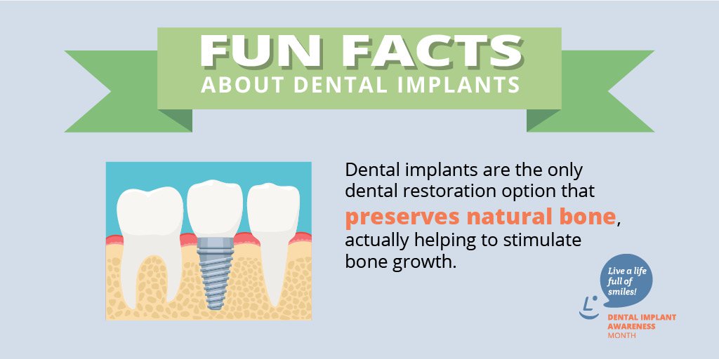 Dental implants fun facts