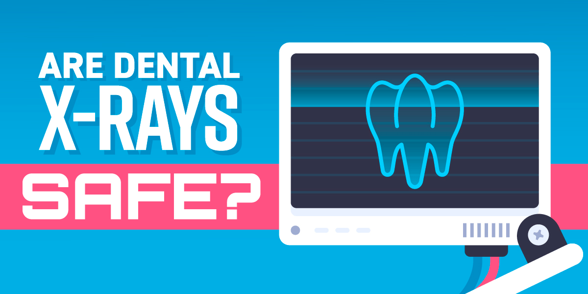 dental X-rays