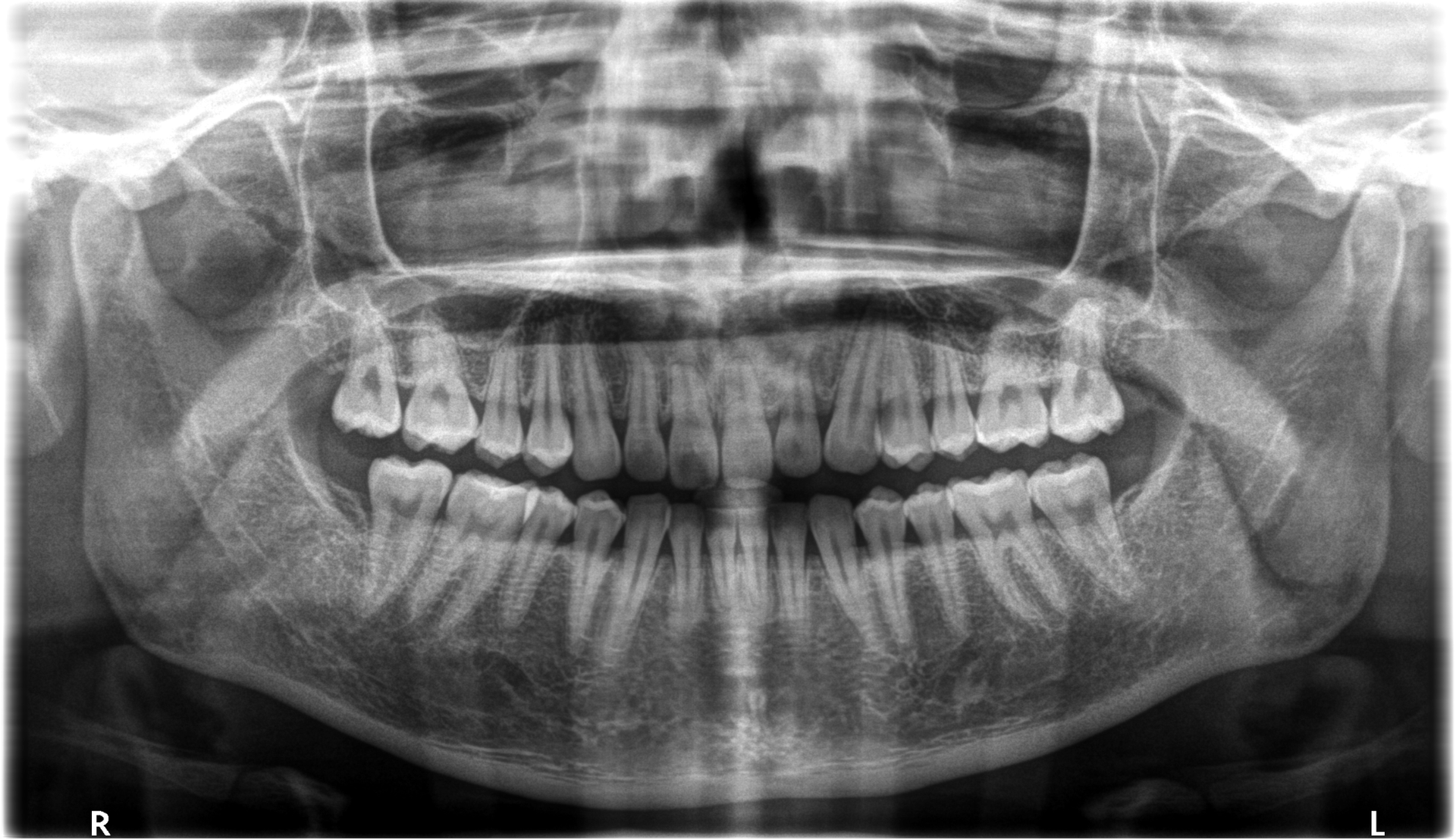 dental X-rays