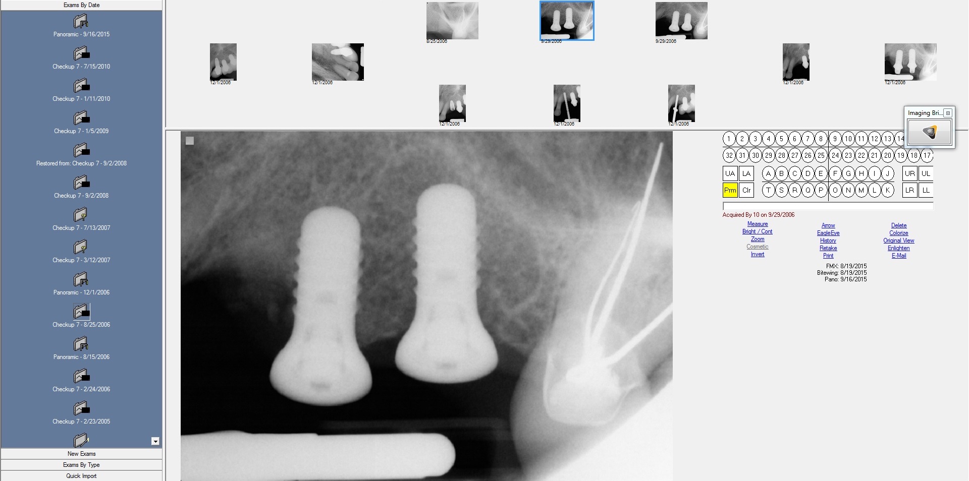 Functioning Implants
